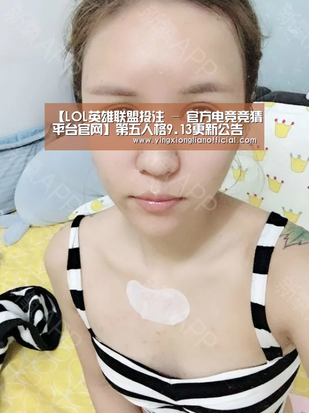 【LOL英雄联盟投注 - 官方电竞竞猜平台官网】第五人格9.13更新公告 舞女上线正式服(图4) 电竞直播